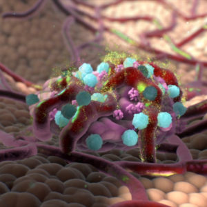 medical animation of tumor for Pieris