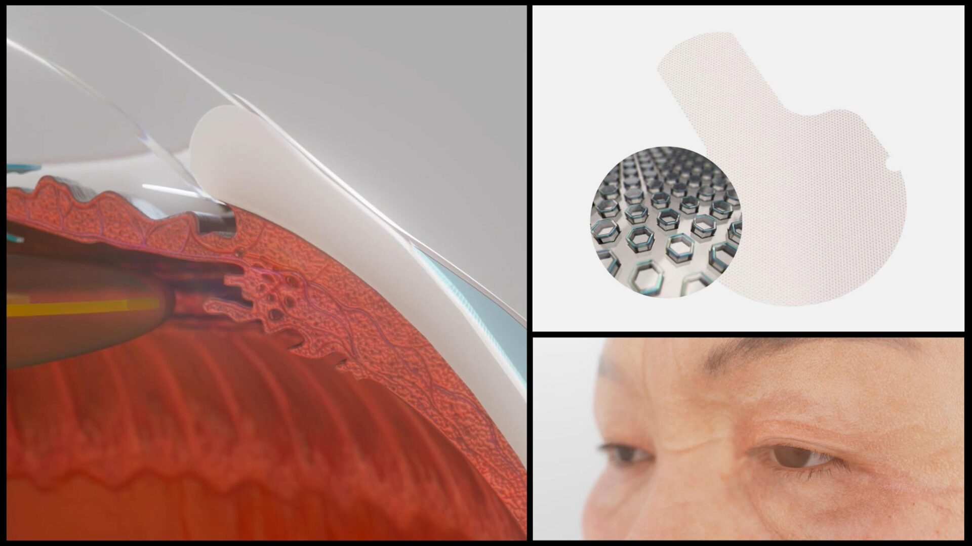 4 Examples of Beautiful Ophthalmology Animation That Showcase the ...