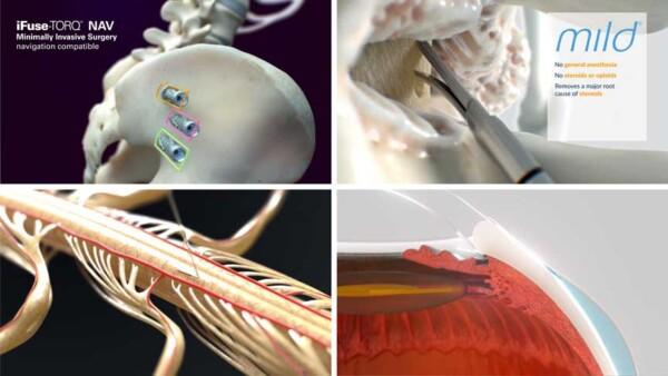 A collection of examples of medical animation